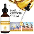 Fast Hair Growth Hair Growth Oil Effective Baldness Repair Hereditary Hair Loss Postpartum Hair Loss