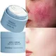 Facial Redness Repair Cream Improve Sensitive Skin Dryness Moisturizer Hydrating Sooth Lotion