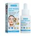 CozyHome Pure Hydration Serum Soothing Face Serum with Hyaluronic Acid and Zinc to Calm Redness and Irritated Skin Ultra-Hydrating Anti-Wrinkle Hyaluronic Acid Serum for All Skin Types