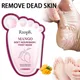 Mango Fuß maske Peeling Dead White ning feuchtigkeit spendende Peeling Erneuerung Pediküre entfernen