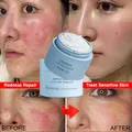 Crème réparatrice efficace pour les rougeurs du visage rosacée peau sensible hydratant