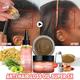2024 Super 5x Hair Growth Oil Set Sevich Fenugreek Anti-Hair Loss Oil Rosemary Hair Regrowth Oil Chebe Batana Butter Hair Mask Amla Oil