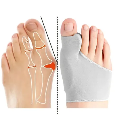 Toe Separator Hallux Valgus Bunion Corrector Orthotics Feet Bone Thumb Adjuster Correction Pedicure
