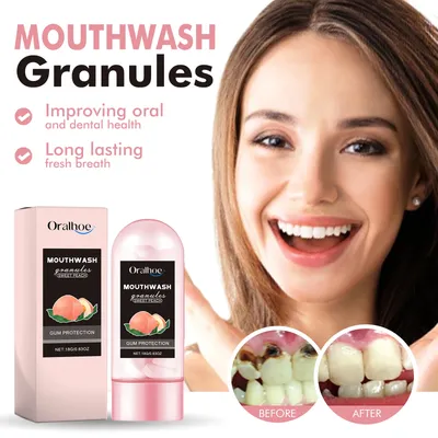 Travel Size Mouthwash Tablets Chewable Tooth Cleaning Tablet to Freshen & Kill Bad Breath