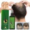 30ML Hair Care Lotion Hair Regrowth Treatment Growth Anti-hair Loss Treatment Essence Men Women Hair