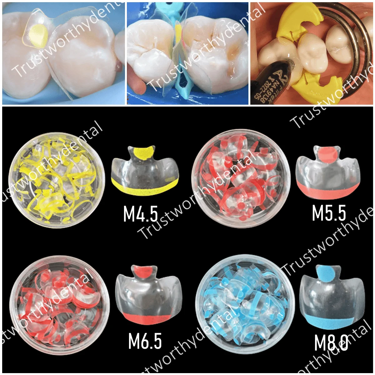 Dental Clear Matrix Posterior Passend für bioklare transparente BT-Matrizen Molar Composite Class Restaurative 4,5/5,5/6,5/8,0 0,038 mm Image