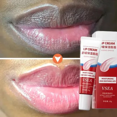 Entfernen Sie dunklen Lippenbalsam, schnell aufhellendes rosa Lippenpeeling, verblassende Lippenlinie, Feuchtigkeitscreme für abgestorbene Haut, koreanische Pflegeprodukte, Schönheit und Gesundheit
