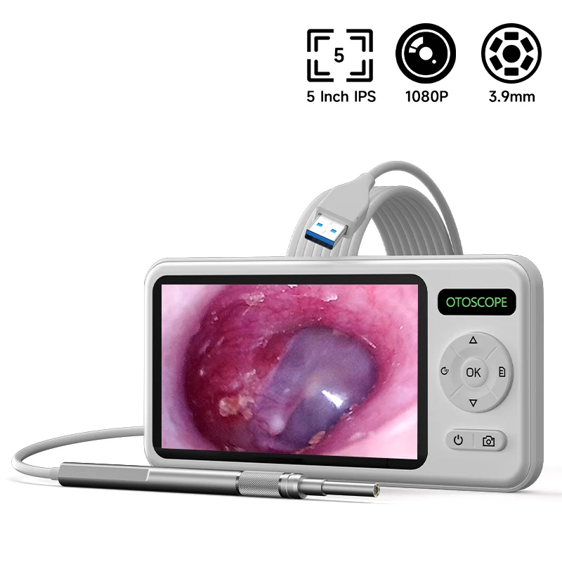 Visuelle Ohrkamera 5'' IPS-Bildschirm HD1080P 3,9 mm digitale Ohrstöpsel USB-Ohrpflücker 6 LEDs Ohrlöffel Video Ohrenschmalzentfernung 3000 mAh Image