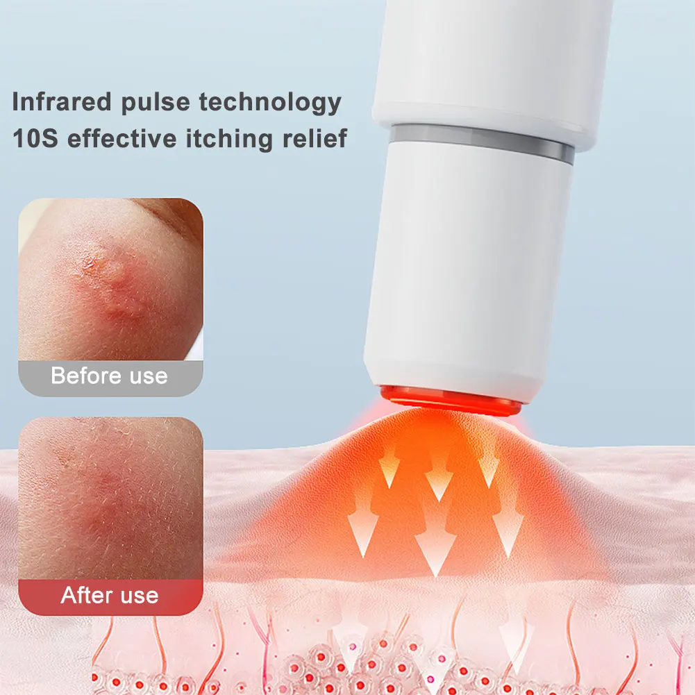 Elektronischer Mückenstift, chemikalienfreier Mückenstift, Wärmestift, Anti-Juckreiz-Stift für Erwachsene und Kinder für Camping, Reisen im Freien Image