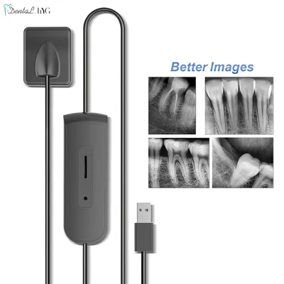 Hochwertiger Dentalsensor mit Halter, schnellere, langlebige USB-Dental-Röntgensensor, intraorale Kamera, digitaler RVG-Sensor