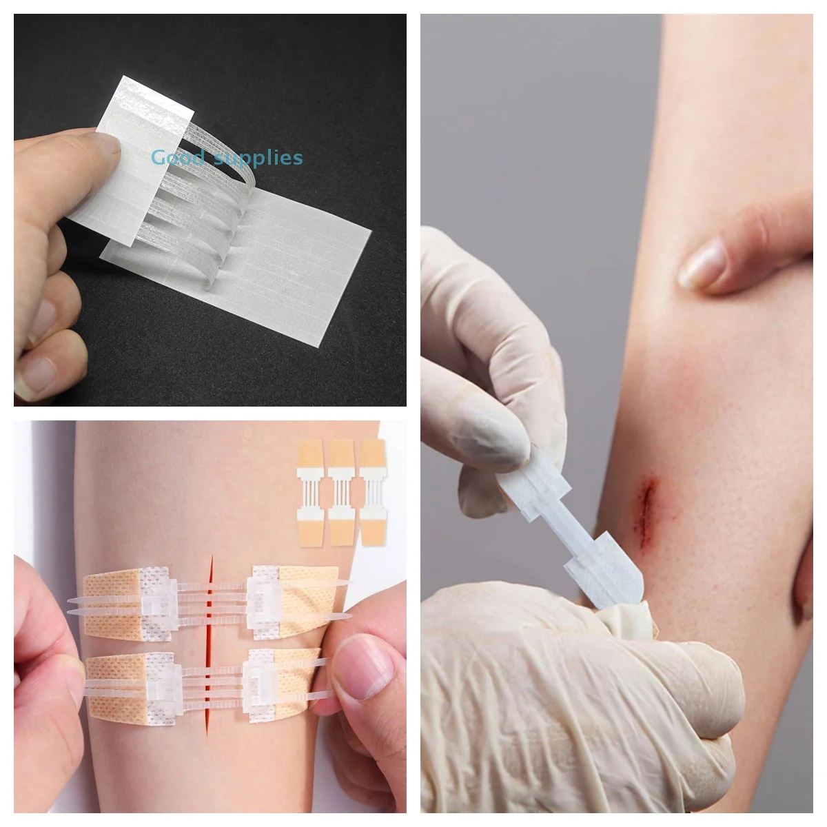 Reißverschluss-Pflaster, schmerzloses Wundverschluss-Pflaster, nahtfreie Wundverband-Pflaster, Reißverschluss-Nahtreduzierer, Pflaster für den Außenbereich, tragbar Image