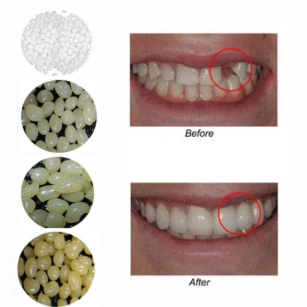 4 Farben Dental Oral Falsche Gefälschte Zähne Zahnfüllung Reparatur Lächeln Snap auf Veneers Zahnersatz Fall Paste Kleber Perlen Kosmetik Image