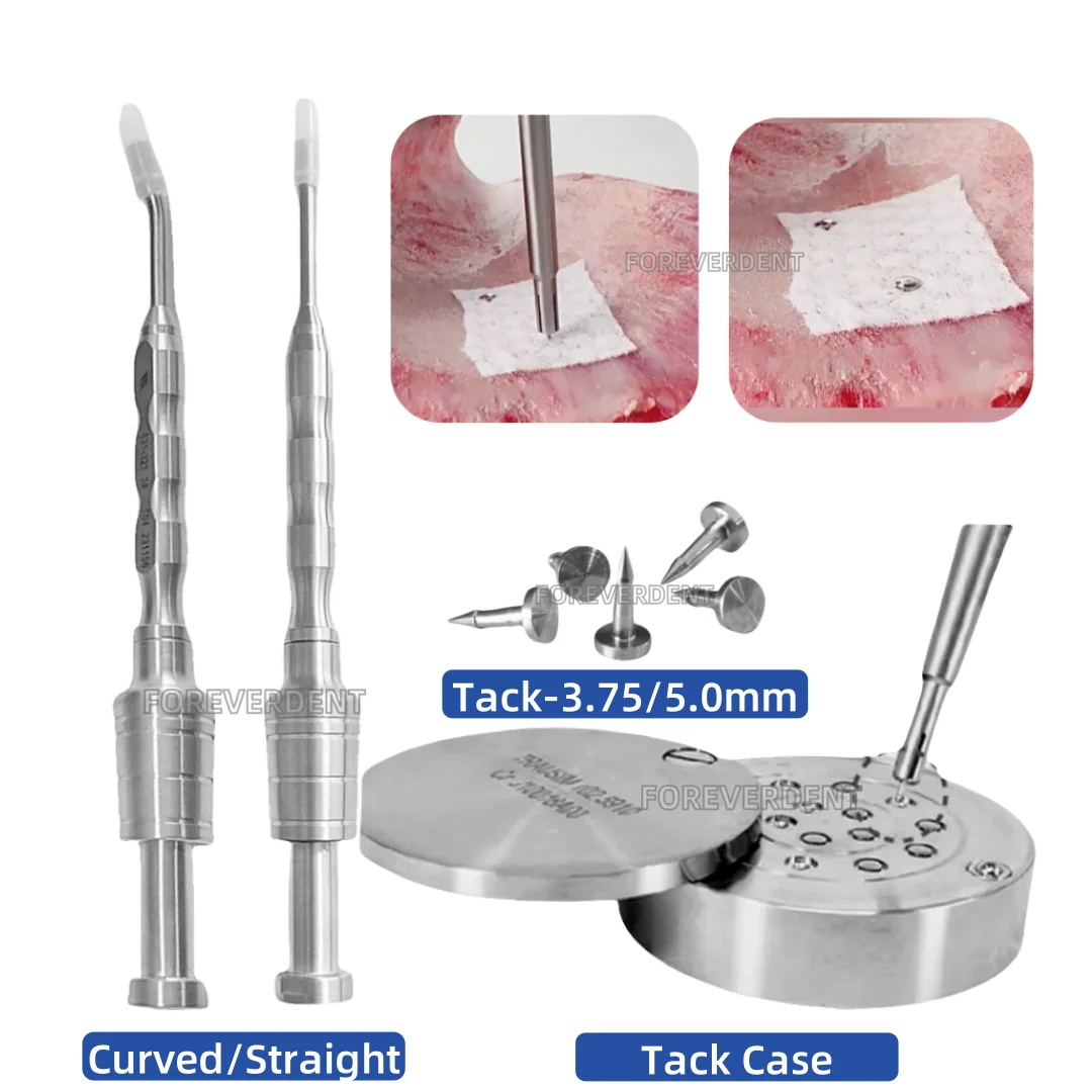 Dental GBR Bone Tack Titan Nagelstifte Set Fahrer Cather Membran Fixierung Stabilisierung Pin Griff GBR Reißzwecken Image