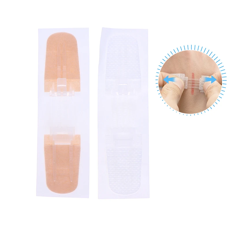 Schmerzloser Wundverschluss, Reißverschluss, Pflaster, nahtfreie Verbandpflaster, Reißverschluss-Nahtreduzierer für eine bequeme Wundverwaltung Image