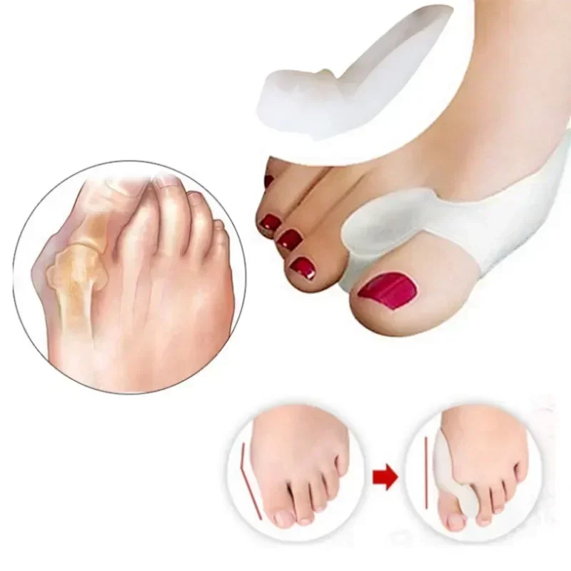 2PCS Werkzeug Silikon Gel Daumen Corrector Bunion Fuß Zu Hallux Valgus Schutz Separator Finger Haarglätter Teller Fuß Pflege Image