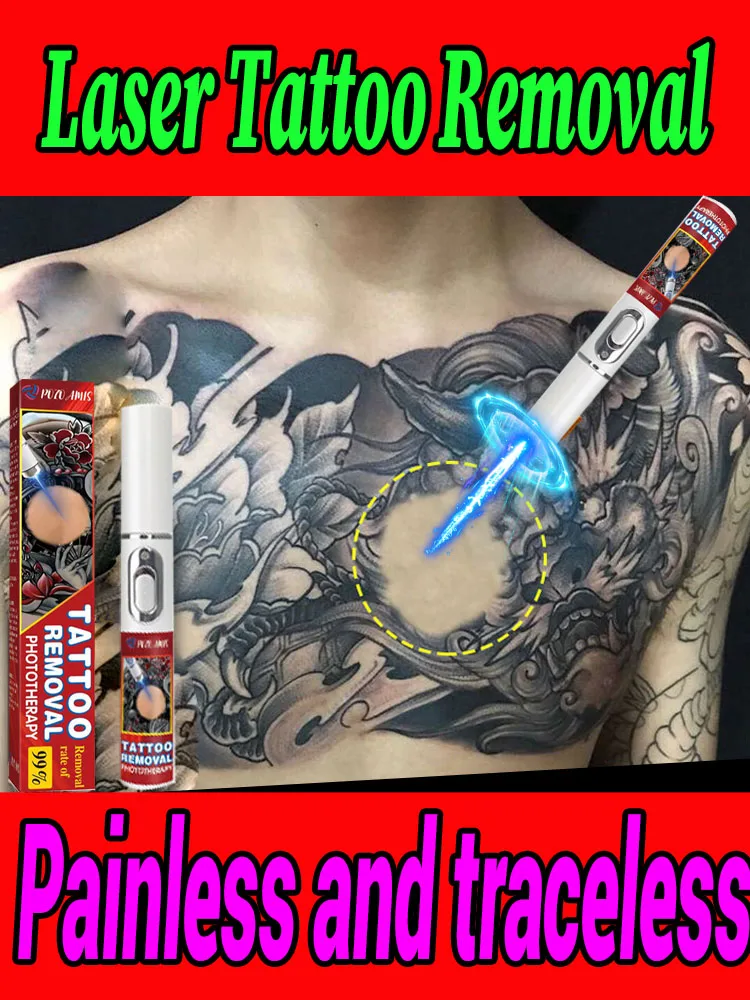 Die Tattooentfernung ist schmerzfrei und hinterlässt keine Spuren, sodass Ihre Haut wieder in ihren ursprünglichen Zustand zurückkehren kann. Image