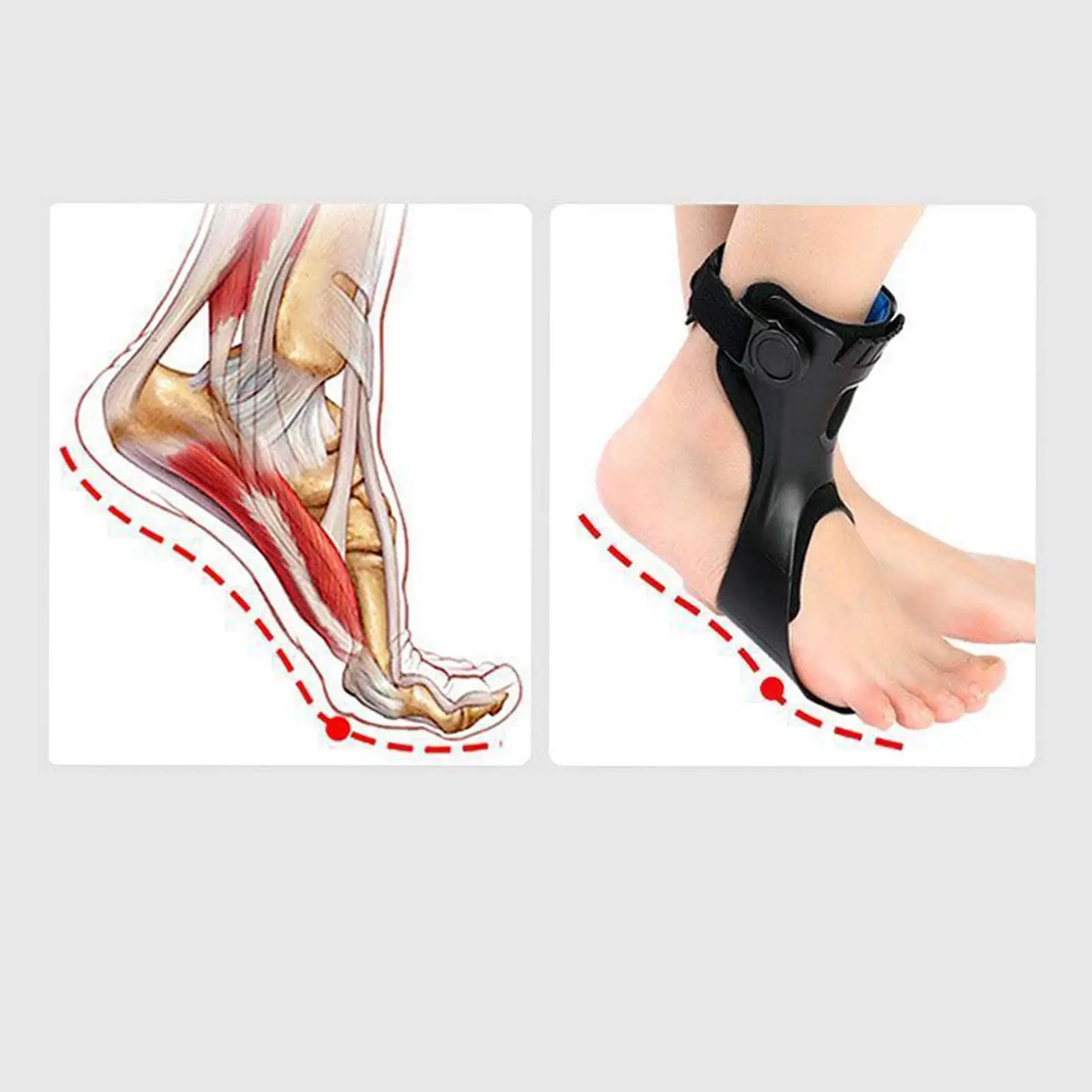 Drop-Foot-Orthese: Fußgelenkstütze mit komfortabler, verstellbarer Schnalle für Hemiplegie, Schlaganfälle und zum Gehen Image