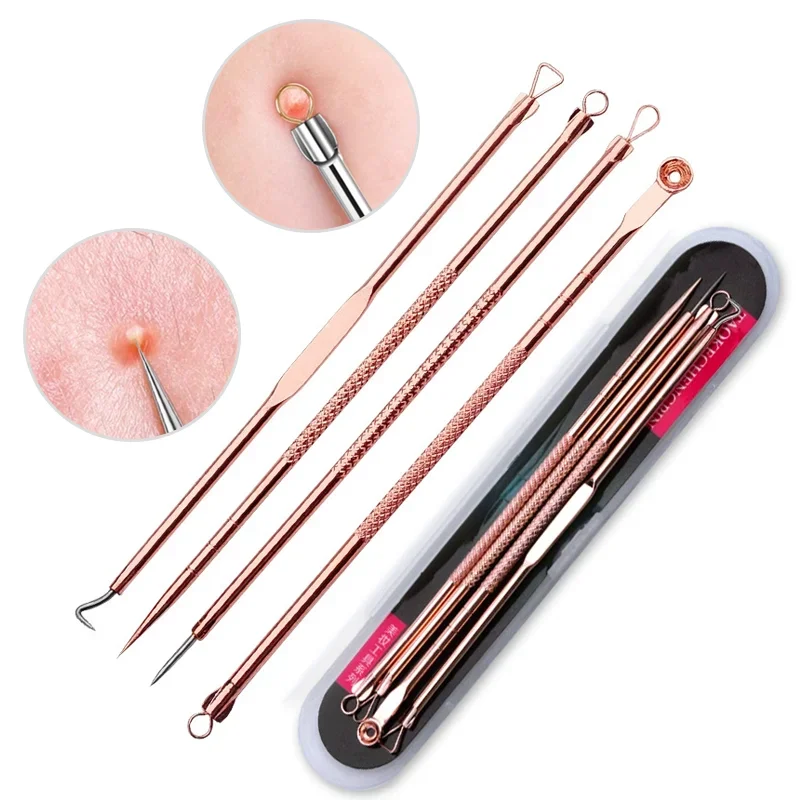 4 teil/satz Akne Blemish Remover Mitesser Extractor Ultra-feine Schönheit Gesicht Poren Reiniger Nadeln Set Akne Nadel Gesichts Reiniger haut Image