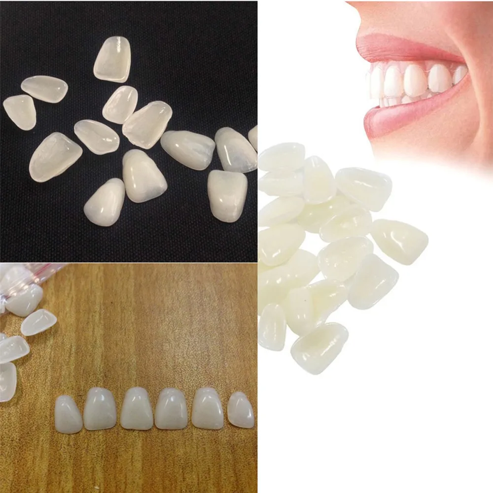 Ultradünne Zahnaufhellungs-Veneers aus Kunstharz für die obere Frontzähne - Bestseller Image