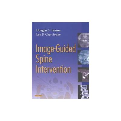 Image-Guided Spine Intervention by Douglas S. Fenton (Hardcover - W.B. Saunders Co)